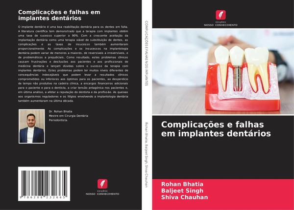 Rohan Bhatia (U. A.) | ComplicaçõEs E Falhas Em Implantes DentáRios | Buch-image