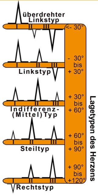 Hawelka Verlag Ekg Lineal Professional Ii - 2015 - Bild 3
