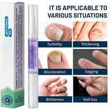 NEW Anti Fungal Pen Intensive Treatment Toenail Fungus Foot Nail Repair Oil