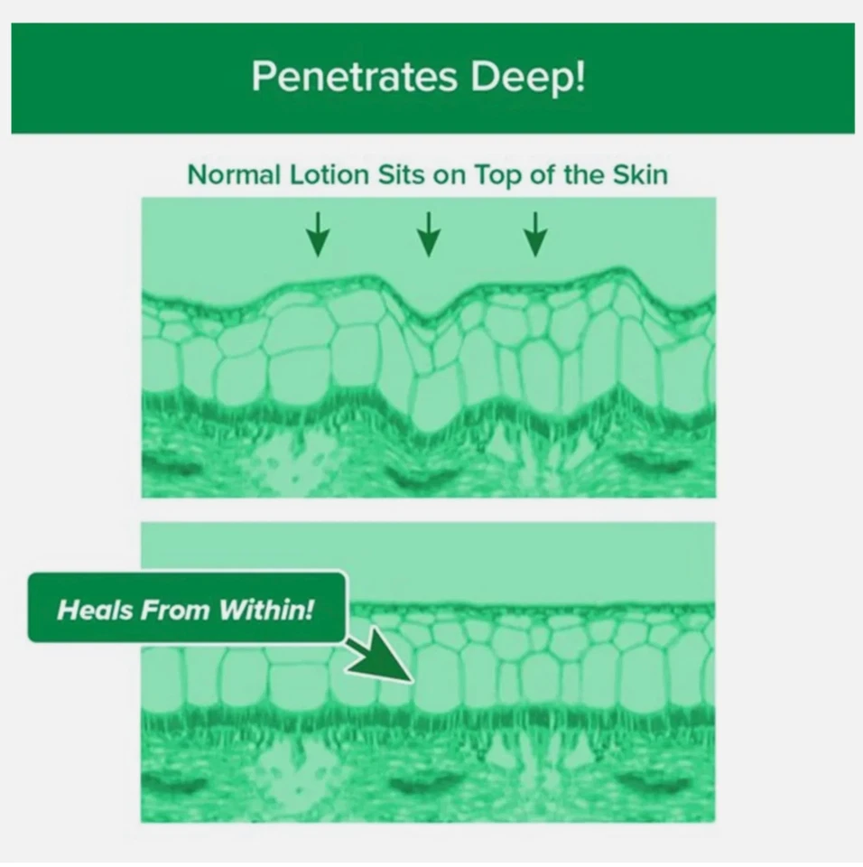 Heel Tastic Terapia Intensiva del Talón, Cuidado de los Pies 2oz, ENVÍO RÁPIDO GRATUITO Foto 4 de 4