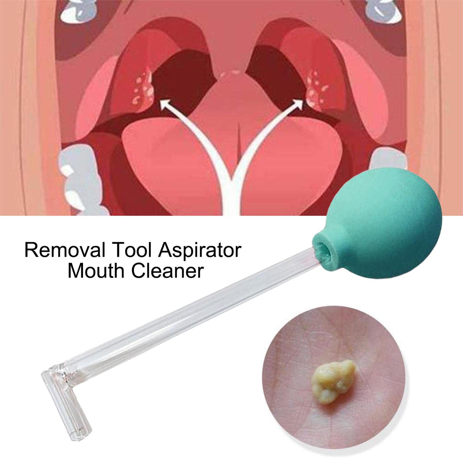 Oral Calculus Cleaning Straw Mouth Cleaner Manual Removal Straws Tonsil