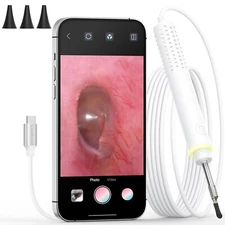 ScopeAround Otoscope 3.9mm Ultra-Thin USB Plug & Play Ear Wax Camera