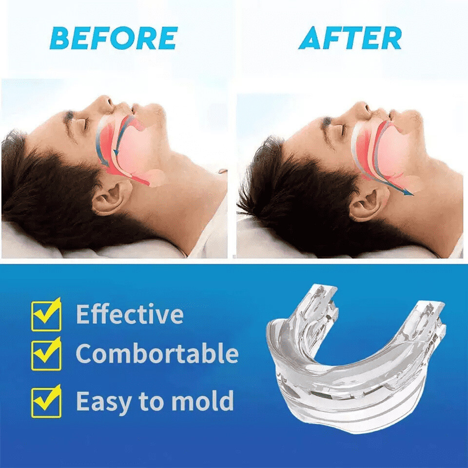 Dream Hero Mouth Guard Dream Hero Anti Snore Dreamhero Anti Snoring dream-hero-mouth-guard-dream-hero-anti-snore-dreamhero-anti-snoring