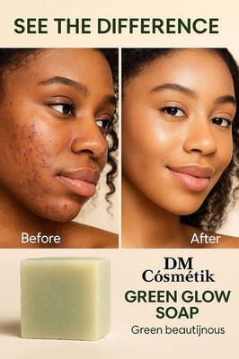 Green Glow Soap Handarbeitsseife Reparatur 