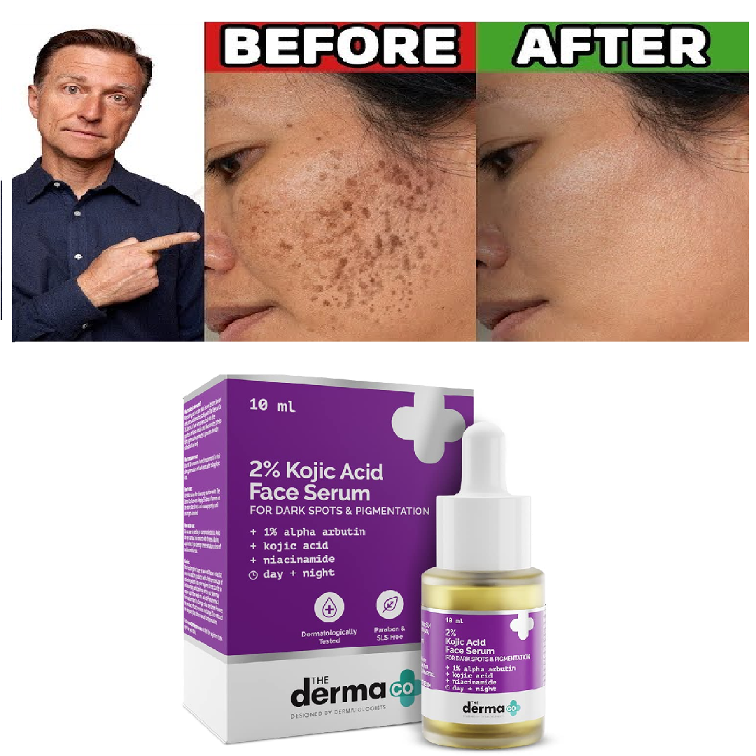 The Derma Co 2% Kojic Acid Face Serum for Dark Spots And Pigmentation - 10  ml | eBay