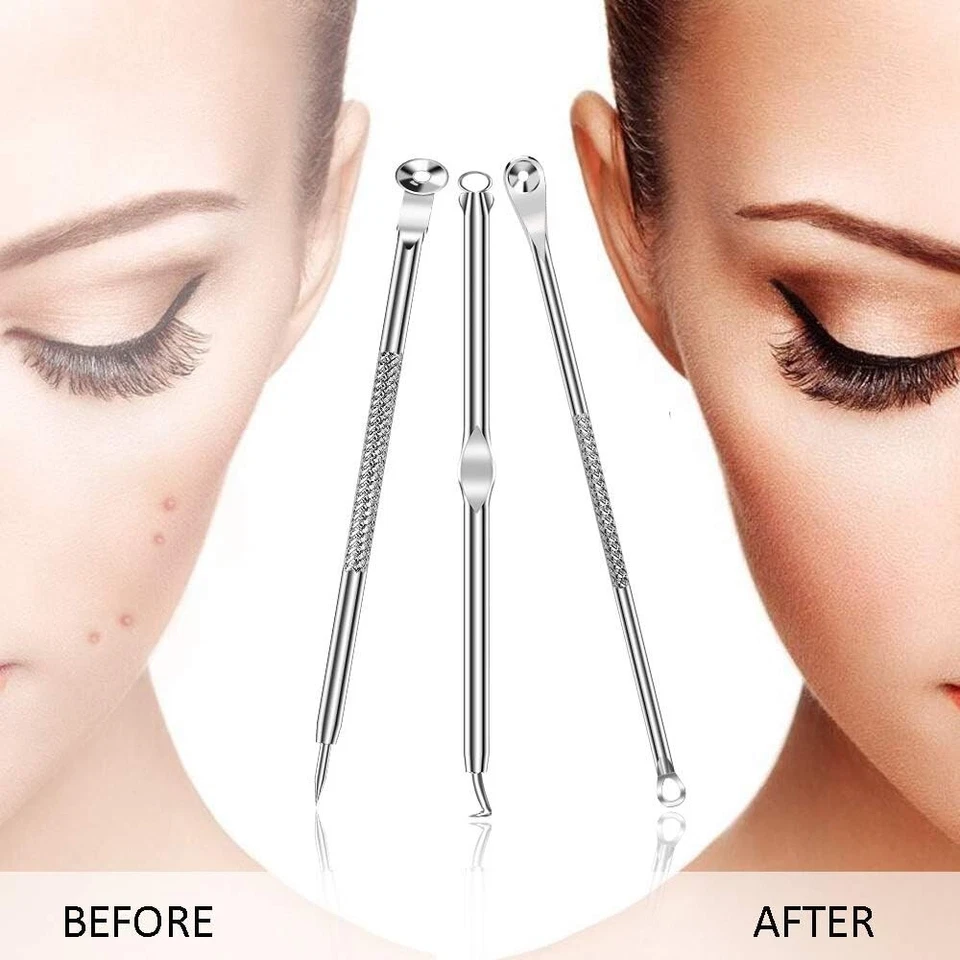 12 Heads Pimple Remover Tool Kit Blackhead Extractor Comedone Acne Spot Popper - Image 2 of 4