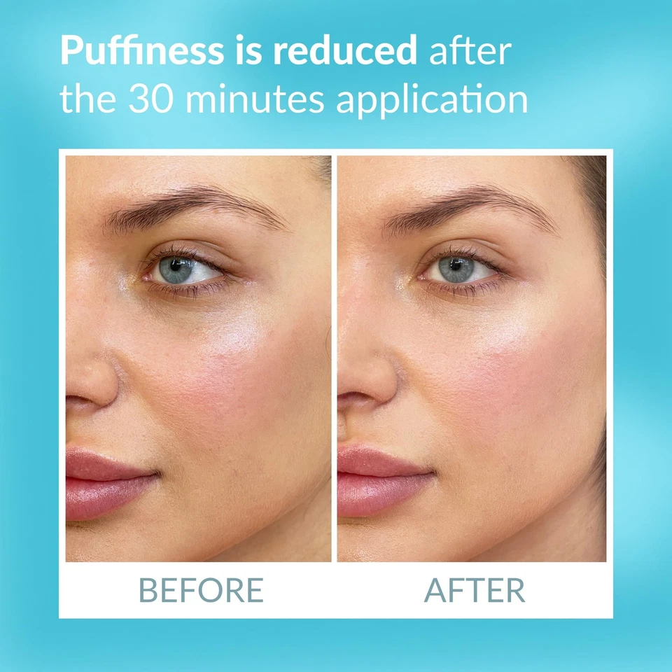 Parche de terapia ocular - Parches de suavizado instantáneo debajo de los ojos - Para ojeras Pu... Foto 3 de 4