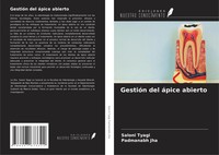 Saloni Tyagi (U. A.) | GestióN Del áPice Abierto | Taschenbuch | Spanisch (2024)