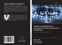 Awarie I Post¿Powanie W Przypadku ChoróB Zwi¿Zanych Z Implantami Manish Dev