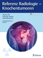Referenz Radiologie - Knochentumoren Markus U...