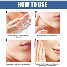 Wart Remover Patches for Skin Corn Treatment with Plant Extracts