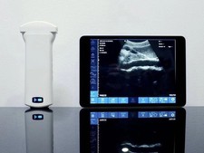 Convex probe handheld color Doppler ultrasound scanner with 192 array elements