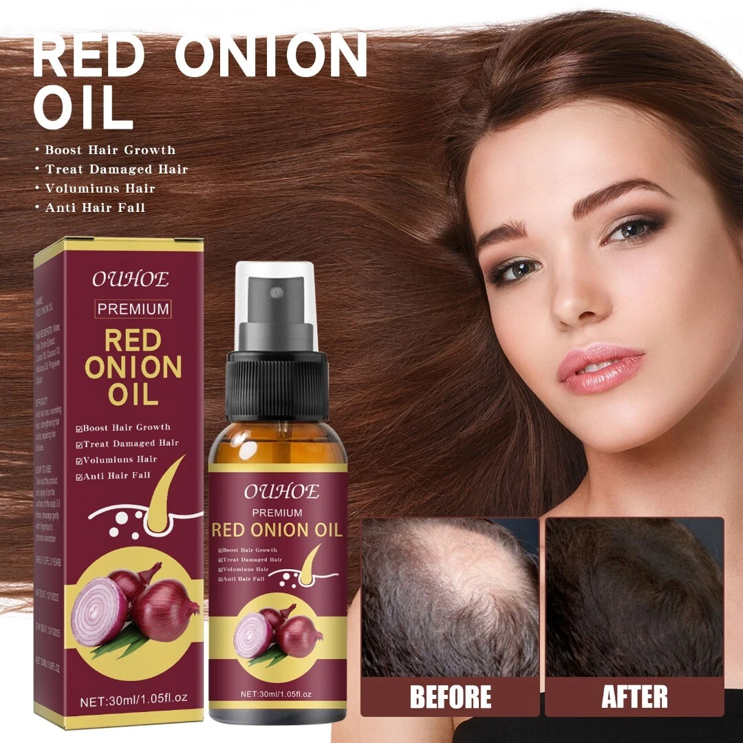 Update 132+ onion water for hair growth super hot tnbvietnam.edu.vn