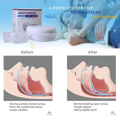 Anti Snore Mouthpiece Sleep Well Mouth Guard Stop Snoring Adjustable Bruxisms - Picture 13 of 13