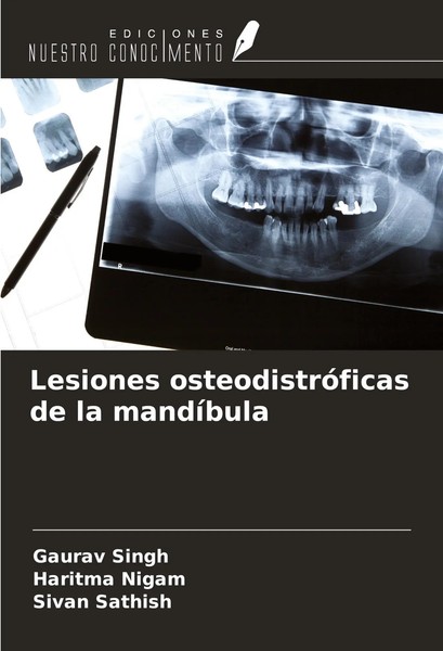 Gaurav Singh (U. A.) | Lesiones OsteodistróFicas De La MandíBula | Taschenbuch-image
