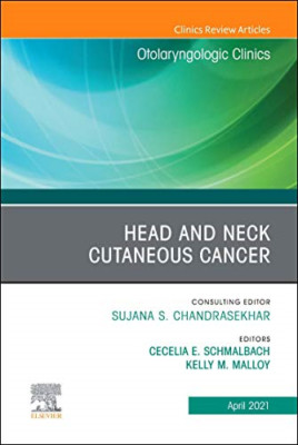 Head and Neck Cutaneous Cancer, An Issue of Otolaryngol - Hardback NEW Schmalbac