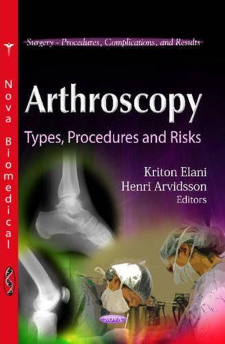 Arthroscopy: Types, Procedures & Risks by Kriton Elani (English) Paperback Book - Afbeelding 1 van 1
