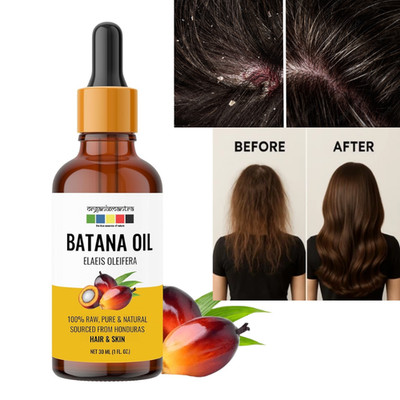 Organix Mantra Batana Oil for Hair Growth,Hair Fall Control & Scalp Health 30 ml