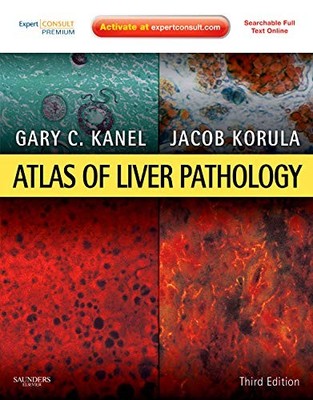 Atlas of Liver Pathology: Expert Consult - Online and Print (Atlas of Surgic...