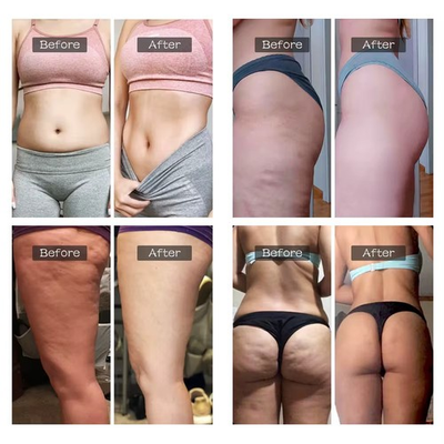 #ad quemador de grasa y reafirmante $39.99