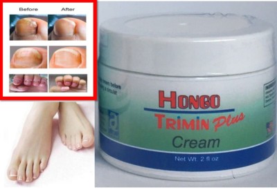 Nail Cream Protector Skin Care Cream Fungus Support Herb Anti Fungal 2onz