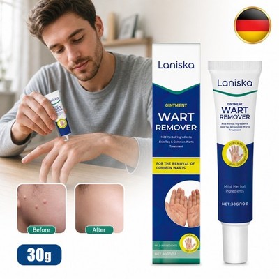 Sanfte Kräutersalbe Warzenentfernung für Hände & Haut nährende Pflegecreme 30g