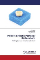 Krithika D. (U. A.) | Indirect Esthetic Posterior Restorations | Taschenbuch