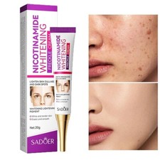 Dark Spot Melasma Hyperpigmentation Freckles Spots Removal Face Cream  Effective