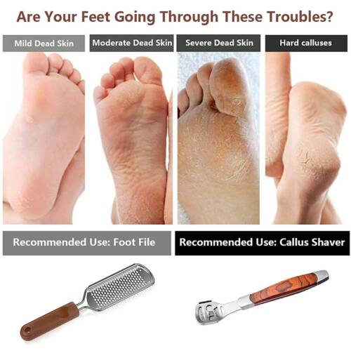 Stainless Steel Foot File Scraper Grater Pedicure Rasp Callus Remover Tool Blade - Picture 2 of 12