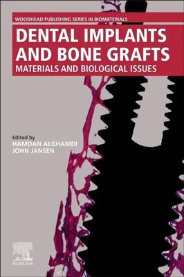 Dental Implants and Bone Grafts | Hamdan Alghamdi (u. a.) | Taschenbuch | 2019