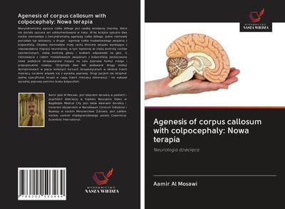 Aamir Al Mosawi | Agenesis of corpus callosum with colpocephaly: Nowa terapia