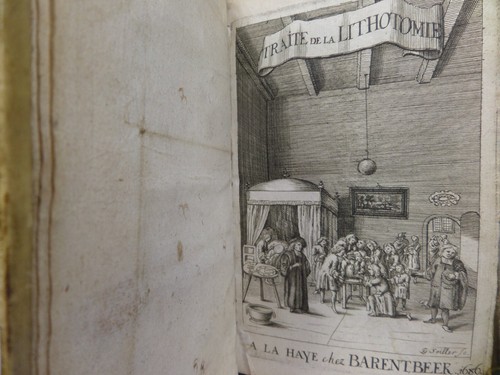 TRAITE DE LA LITHOTOMIE OU DE L'EXTRACTION DE LA PIERRE HORS DE LA VESSIE 1686 - 第 3/24 張圖片