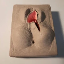 Nasco Life Form Episiotomy Suturing Simulator Right Mediolateral, Childbirth Aid
