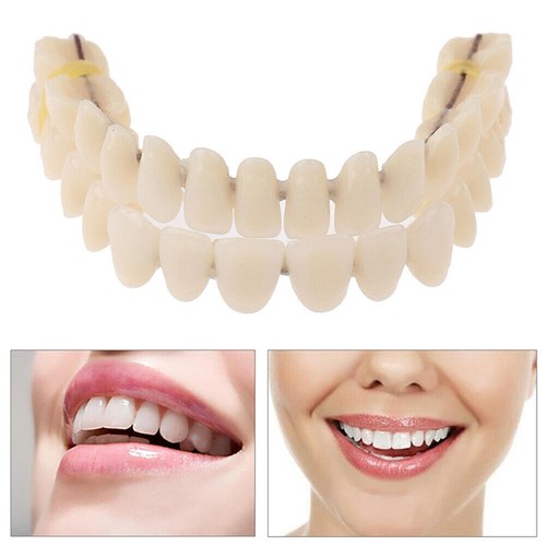 Set di protezioni per la bocca per denti finti superiori e inferiori a scatto co - Foto 4 di 13