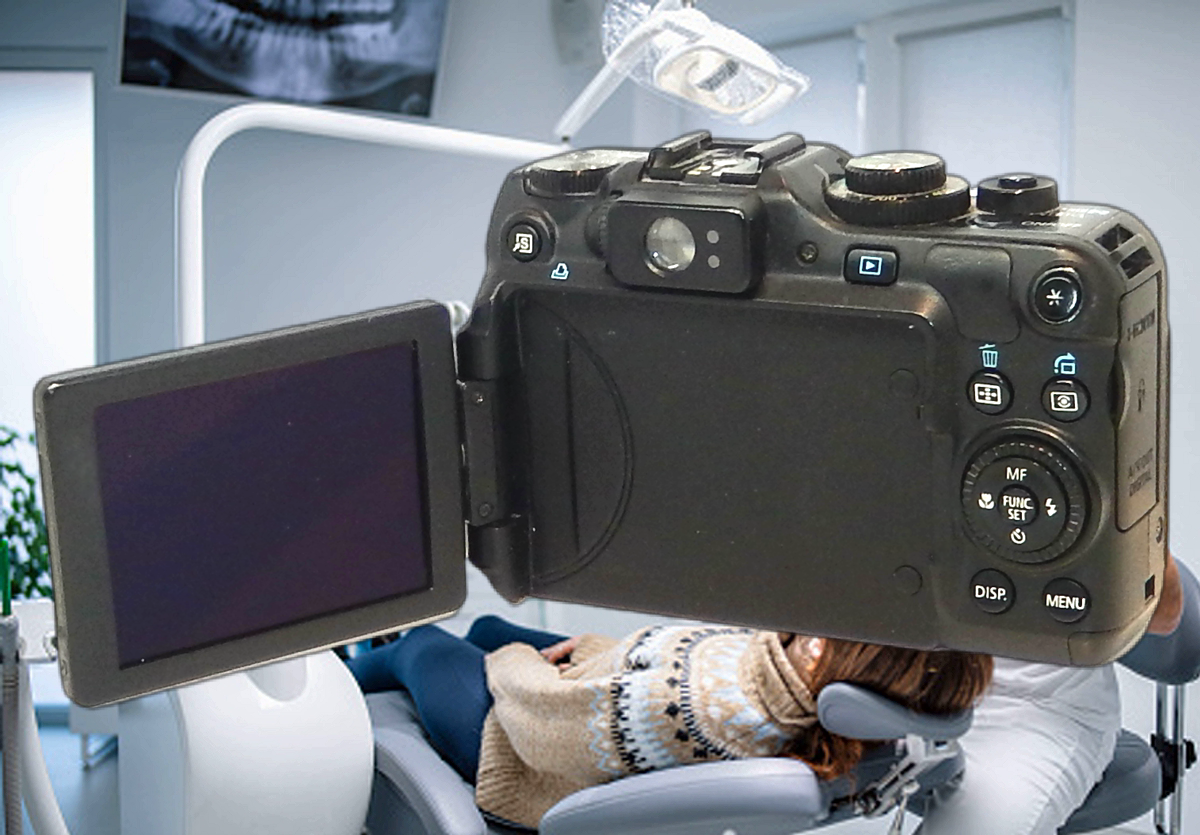 DENTAL CAMERA CANON G12 Digital Set Up For Intraoral Orthodontic