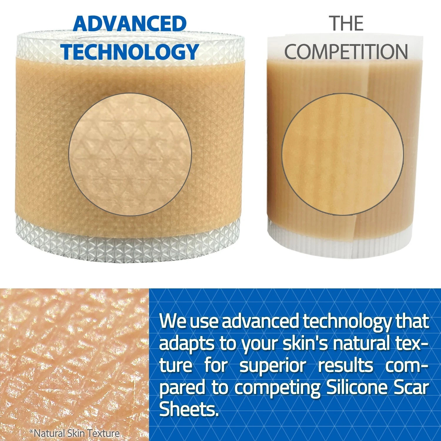 3M Reusable Silicone Scar Sheets Tape - Effective Scar Removal Comparison