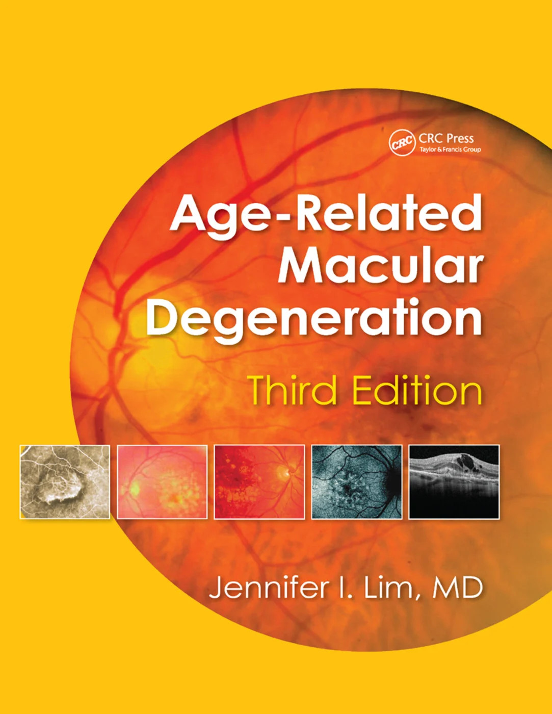 Age-Related Macular Degeneration, Third Edition - 3rd Edition