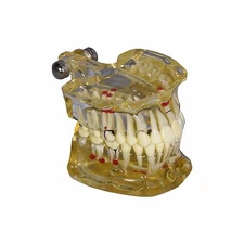 (Redland) Dental Demonstration Teeth Educational Model #1075