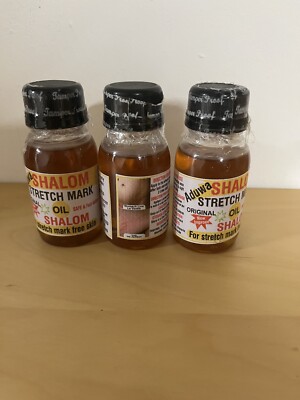 Shalom stretch mark oil