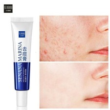 Face Skin Care Acne Treatment Removal Cream Spots Scar Blemish Marks