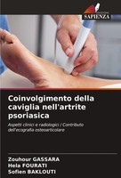 Coinvolgimento Della Caviglia Nell'artrite Psoriasica Zouhour Gassara