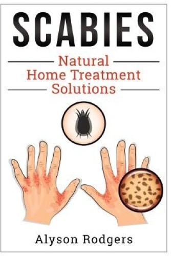 Scabies Natural Home Treatment Solution by Alyson Rodgers [Paperback]