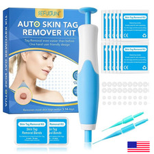 Auto Micro Skin Tag Remover Device Kit Safe Painless Removal 2-8 mm Band Tool