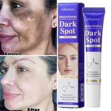 Dark Spots Removal Cream Facial Whitening Freckle Acne Mark Pigmentation Removal