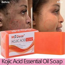 Kojic Acid Soap Dark Spot Whitening Turmeric Soap Skin Bleaching Lightening 100g