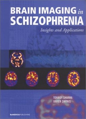 Brain Imaging in Schizophrenia: Insights and Applications By Ton