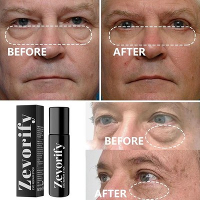 Zevorify Eye Repair Stick for Men - Caffeine Under Eye Roller for