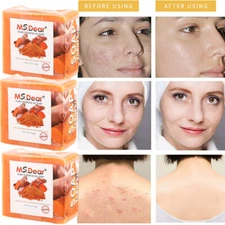 3PCS Tumeric Soap for Dark Spots Skin Whitening Lightening Acne Brightening Soap