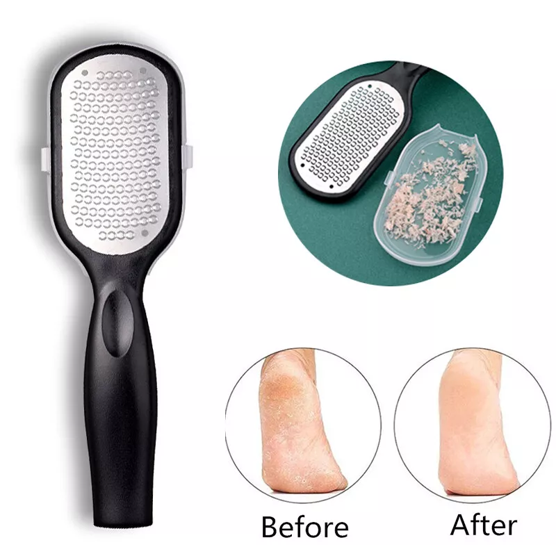 Foot Care File Heel Cocoon Scraper Grater Pedicure Rasp Callus Dead Skin  Remover