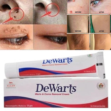 Genital Wart  HPV Removal Cream 25 gm improve skin texture for men  women
